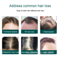 Антимочная выпадение волос, повышающая сыворотку роста волос